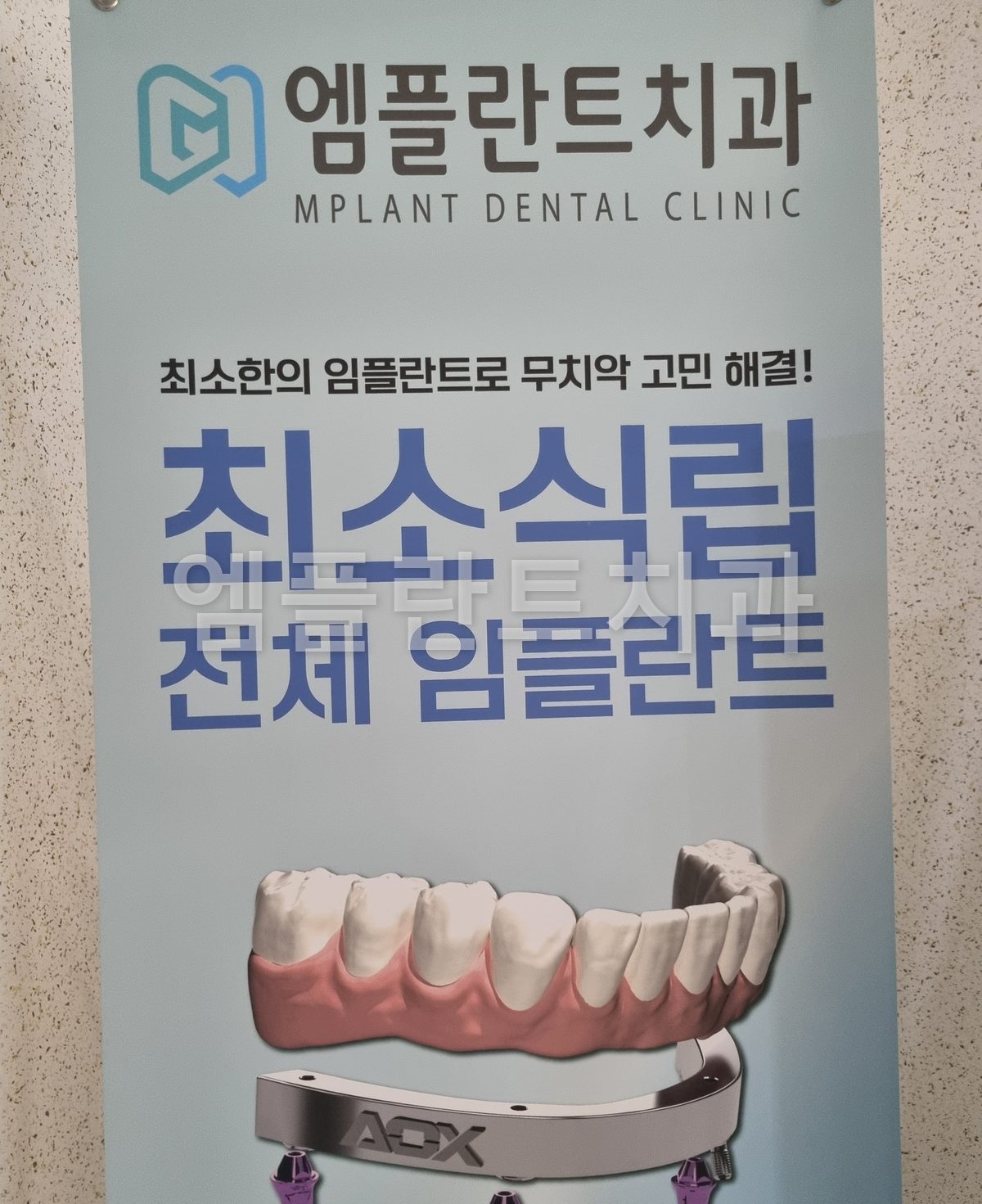엠플란트치과 최소식립 전체 임플란트 입간판 — 임플란트 위에 AOX 금속 바와 치아가 얹히는 구조 그림